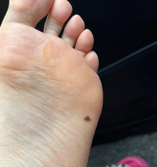手机放置脚底拍照时的技巧和效果如何？