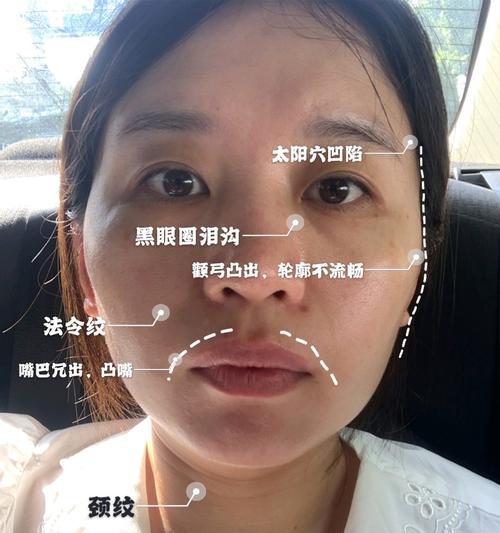 手机拍照不清晰如何改善？